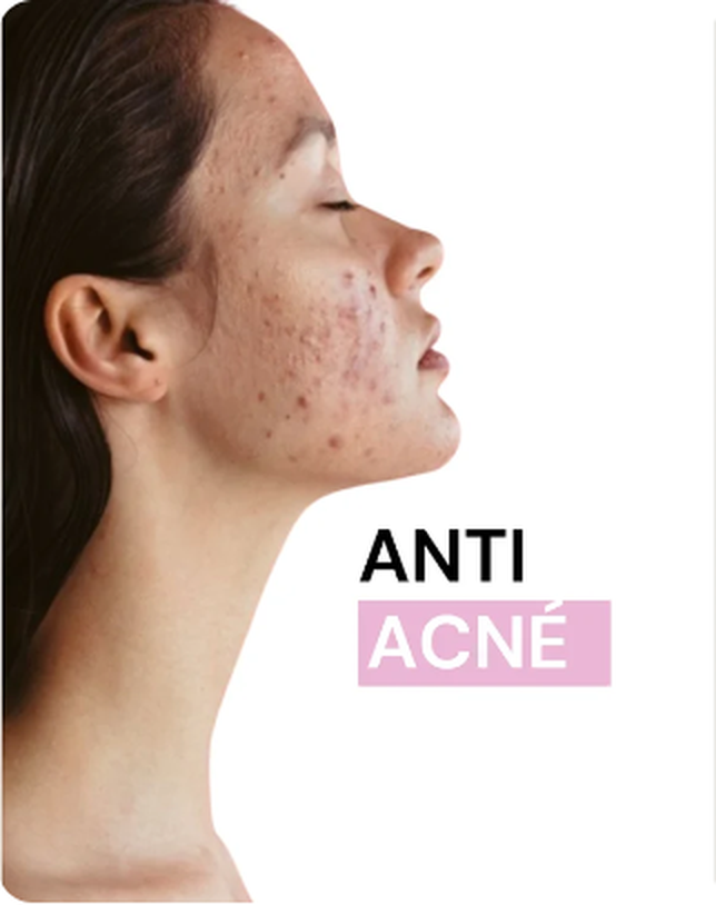 ANTI ACNE